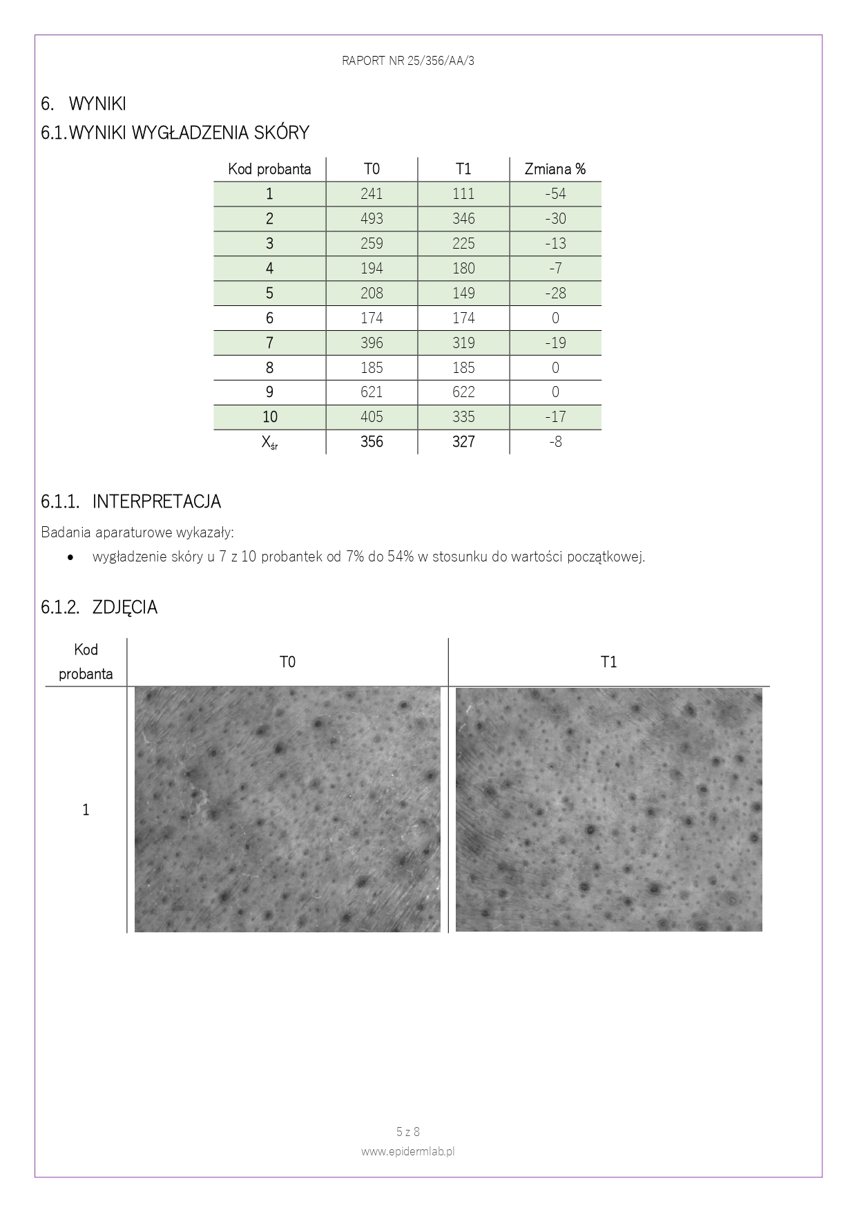 25_356_AA_3 Peeling enzymatyczny JOKAPROSKIN_page-0005