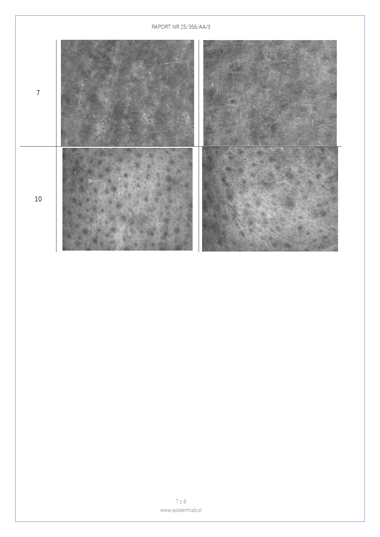 25_356_AA_3 Peeling enzymatyczny JOKAPROSKIN_page-0007