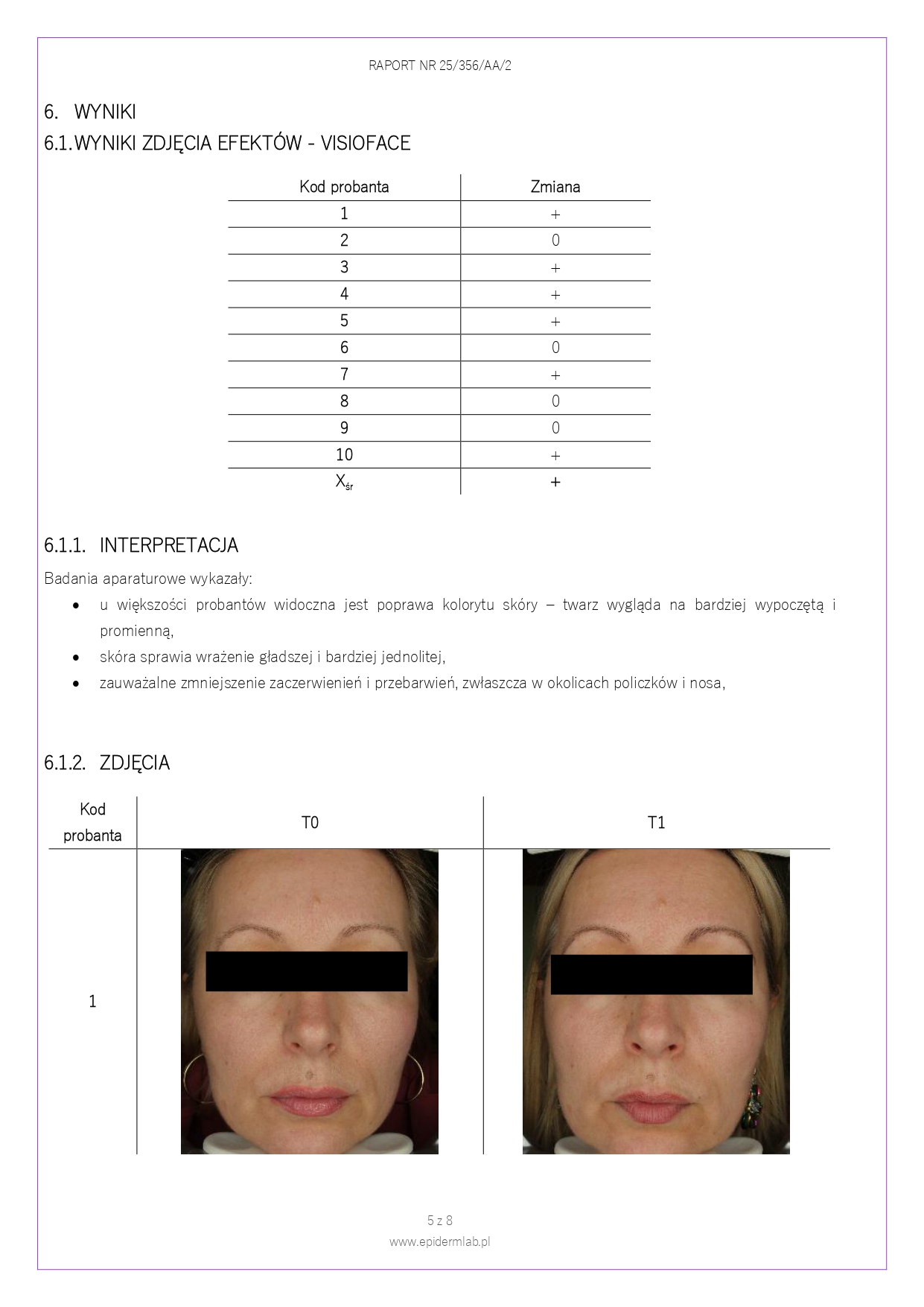 25_356_AA_4 Peeling enzymatyczny JOKAPROSKIN_page-0005