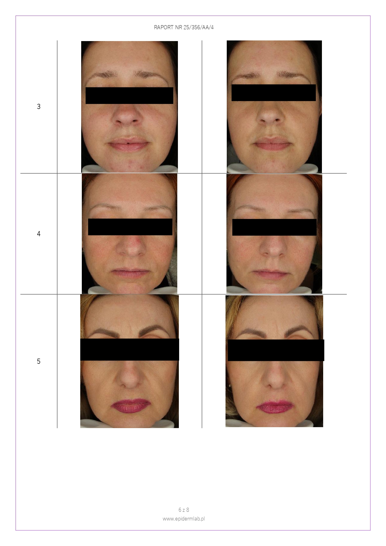 25_356_AA_4 Peeling enzymatyczny JOKAPROSKIN_page-0006