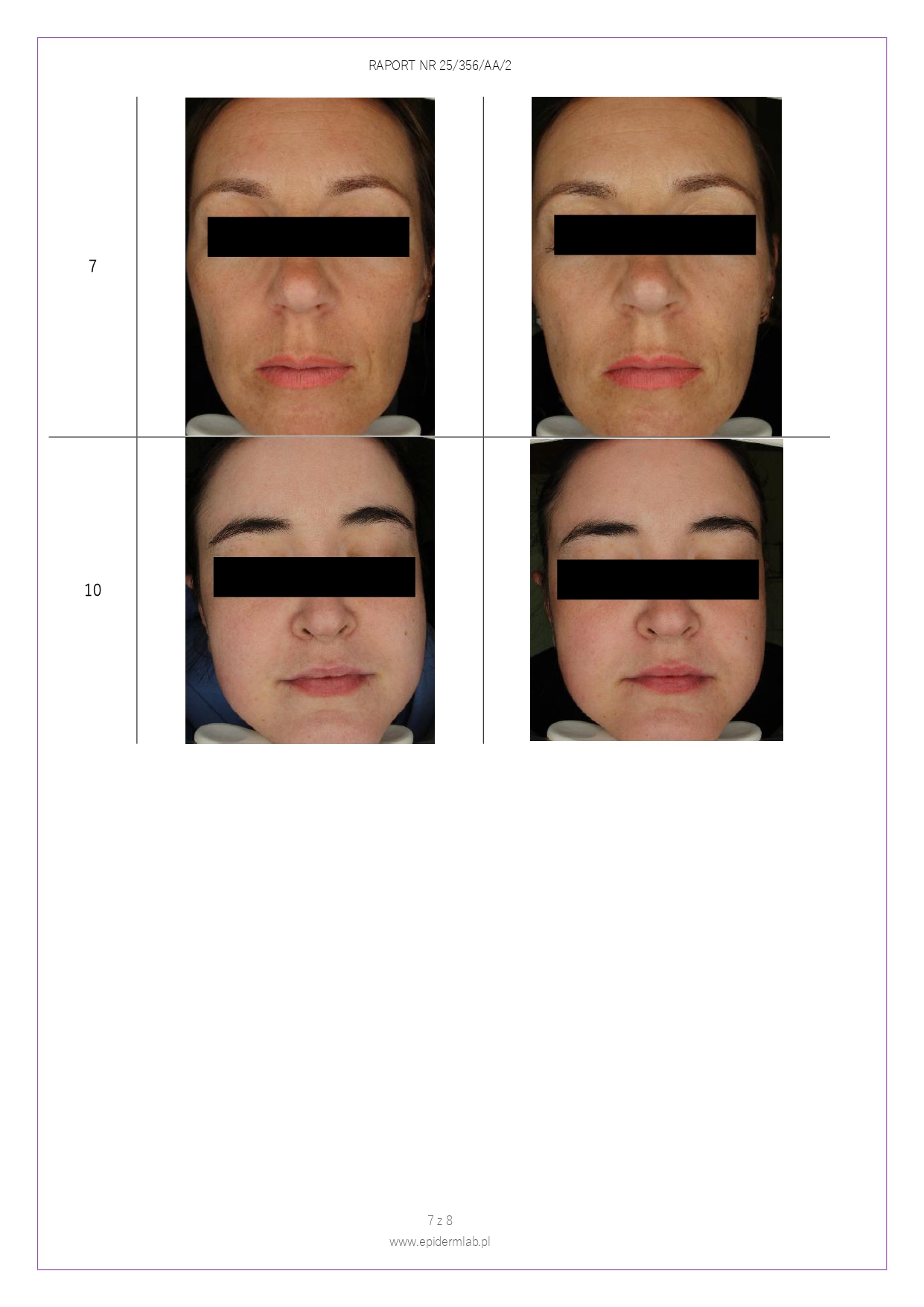 25_356_AA_4 Peeling enzymatyczny JOKAPROSKIN_page-0007