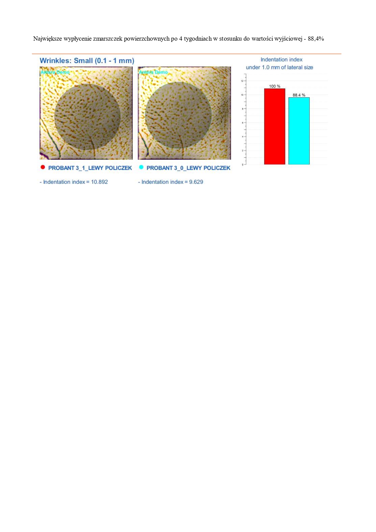 CPIT_021_05_2025_PL_JOKAPRO_NOURIVA VITAL - SPECJALISTYCZNY DERMOKOSMETYCZNY KREM PRZECIWZMARSZCZKOWY_page-0006